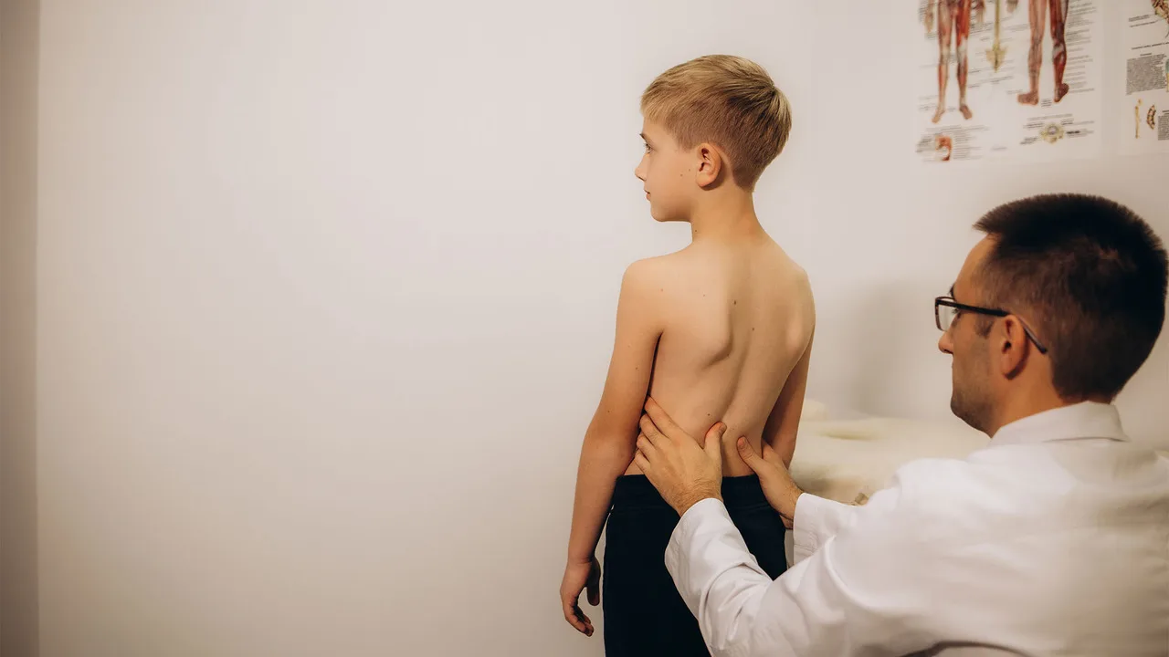 Scoliosis in Children