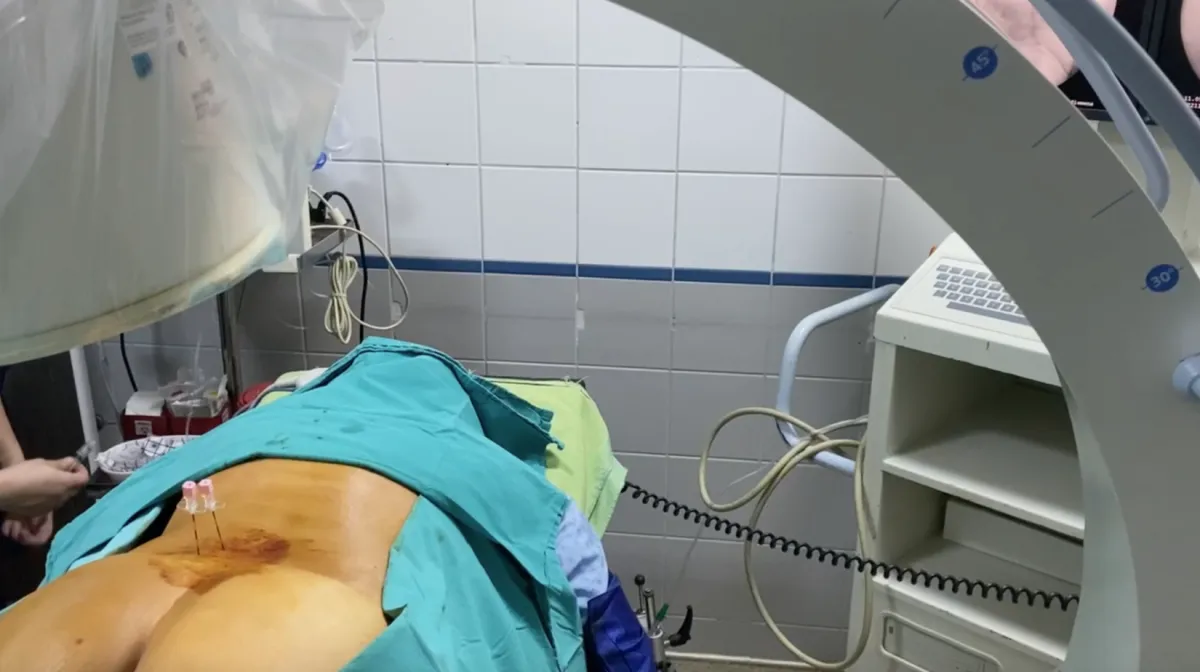 Floroskopi eşliğinde enjeksiyon işlemi